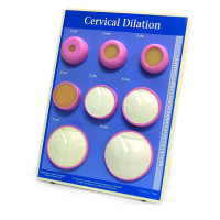 Cervical dilatation model