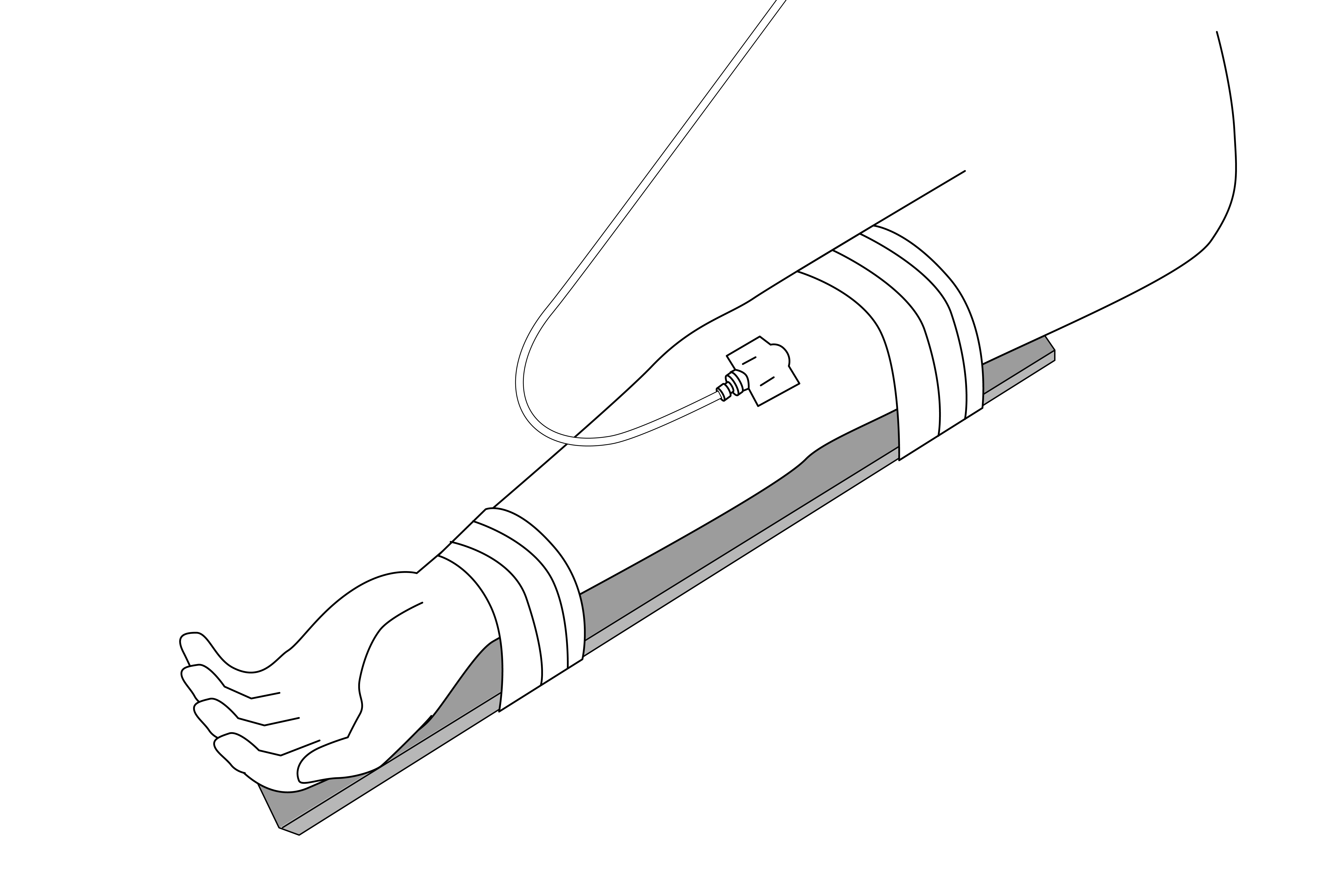 Infusion Arm Splint, Foldable, Child